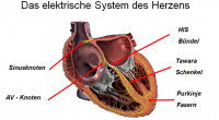 elektrische-herzleitungssystem-kardiologie-angiologie-waldkrankenhaus-erlangen
